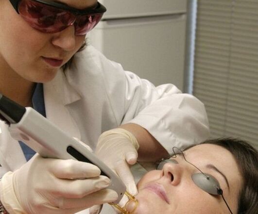Facial skin rejuvenation procedure with laser
